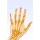 Przy osteoporozie zwykły upadek na równej drodze z podparciem się ręką, powoduje złamanie nadgarstka.    