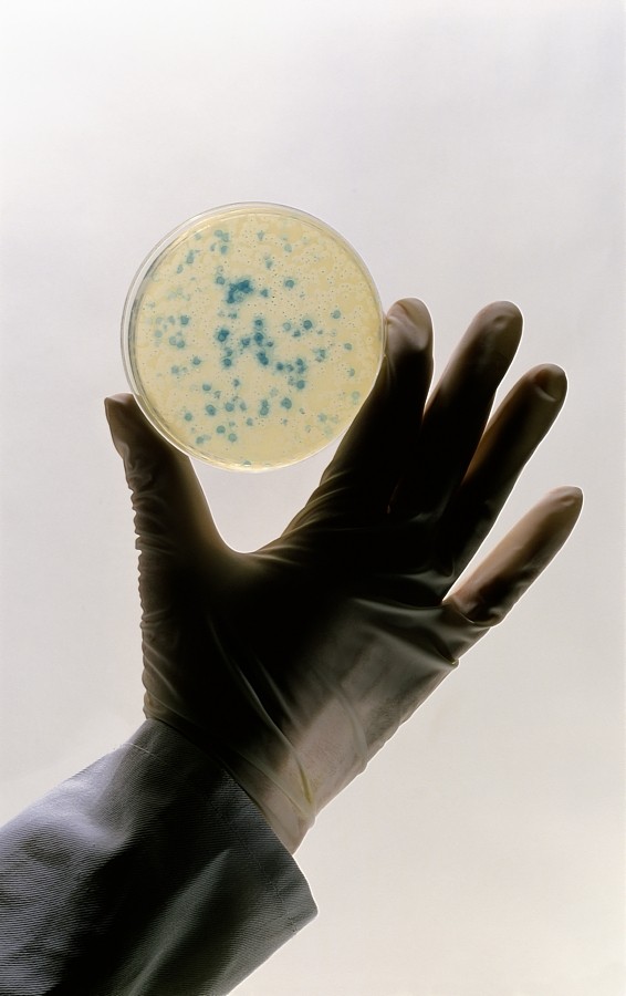 M.in. bakterie wywołują infekcje dróg moczowych.     