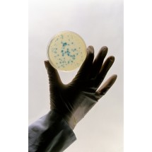 M.in. bakterie wywołują infekcje dróg moczowych.     