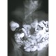 Uchyłki najlepiej uwidacznia rentgen jelita grubego po podaniu kontrastu. Ale uchyłkowatość jelita grubego można też stwierdzić w kolonoskopii.    