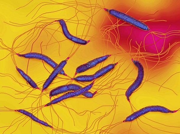 Infekcja bakteriami Helicobacter pylori może być przyczyną choroby wrzodowej.       