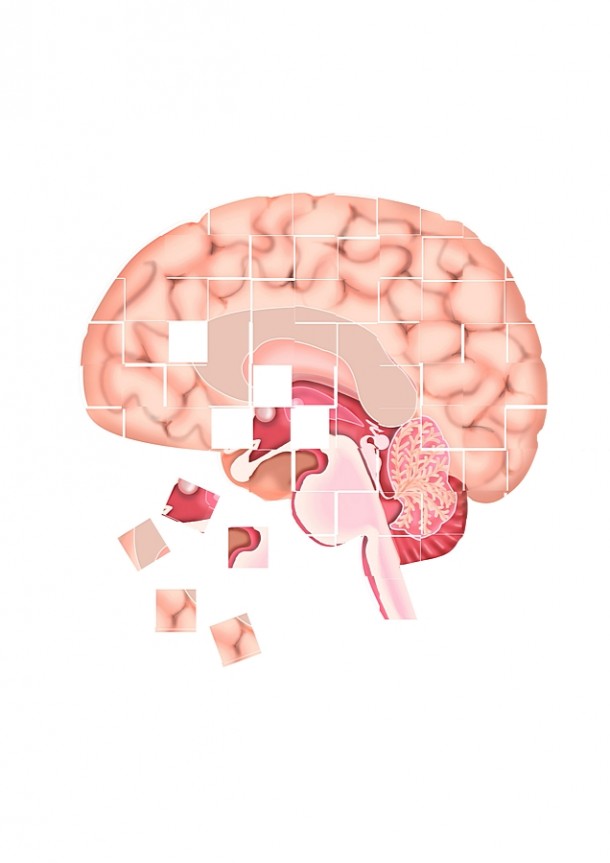 Chorobę Alzheimera mi.n. charakteryzują zaburzenia pamięci, rozumienia, myślenia, liczenia, mowy, możliwości uczenia się.     